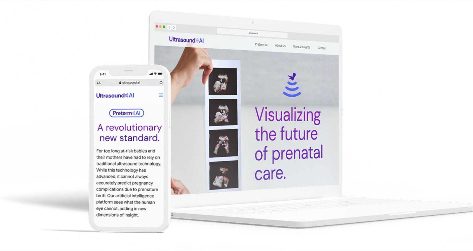 Ultrasound AI website on laptop and mobile